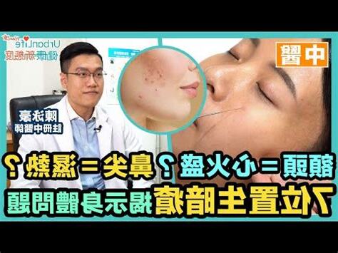 印堂 暗瘡